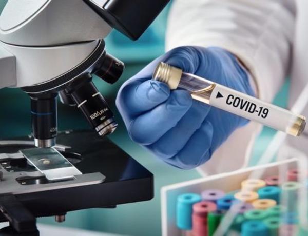 Azərbaycanda daha 315 nəfər COVID-19-a yoluxub, 5 nəfər vəfat edib