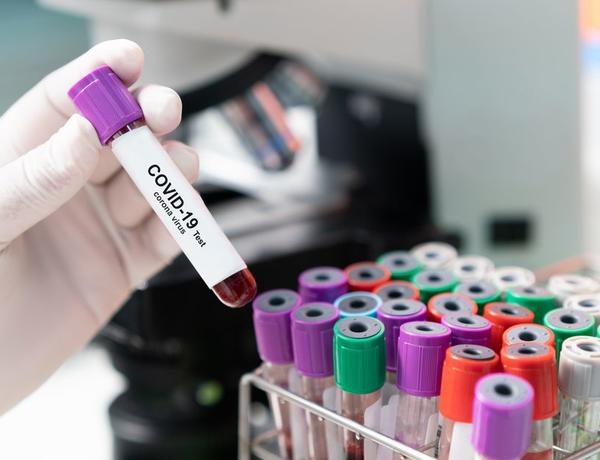 Özəl klinikalarda koronavirus testi niyə bahadır? – TƏBİB-dən AÇIQLAMA