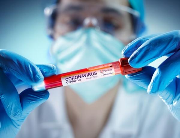 Azərbaycanda koronavirusla son statistika açıqlandı