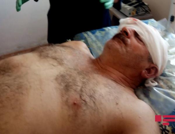 Ermənilərin Ağdam istiqamətində mərmi atəşi nəticəsində mülki şəxs yaralandı