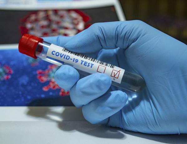 Azərbaycanda koronavirusa sutkalıq yoluxma sayı 500-ü ötdü
