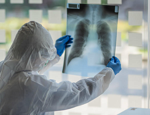 Koronavirus daşıyıcıları əsasən 20 yaşa qədər olan vətəndaşlardır