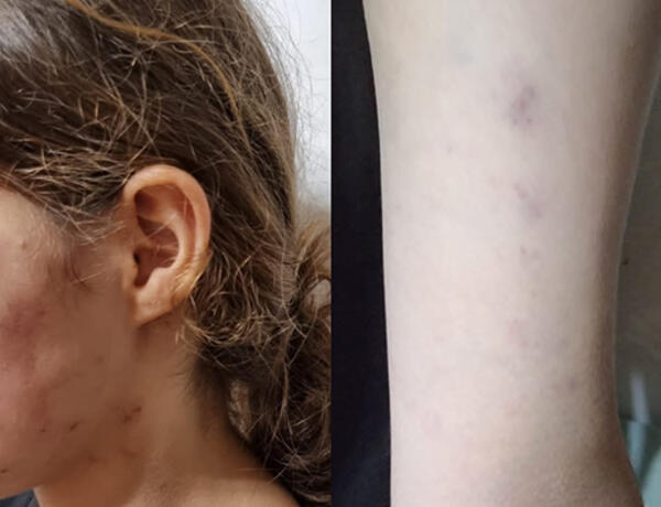Lənkəranda məktəblinin döyülməsi ilə bağlı cinayət işi başlandı