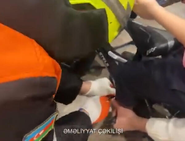 Ayağı velosipedin pedalına sıxılı qalan 3 yaşlı uşaq belə xilas edildi –