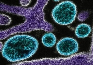 Fransada Şamonda virusundan ilk insan ölümü qeydə alınıb